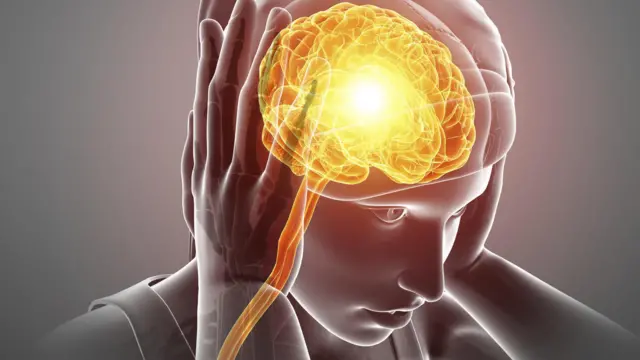 ¿Qué es una migraña? 